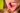 close – up on the lip with aphthous stomatitis